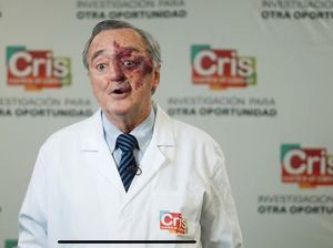 Viral Ilmuwan Spanyol Open Donasi demi Uji Klinis Kanker Pankreas, Butuh Segini