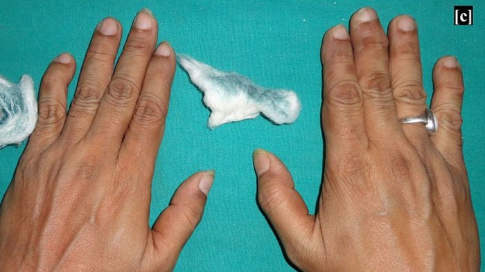 Pria memiliki keringat hijau kebiruan.