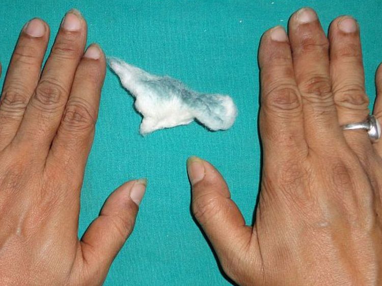 Foto: Dokter Tangani Pasien Berkeringat Hijau, Ternyata Ini Penyebabnya