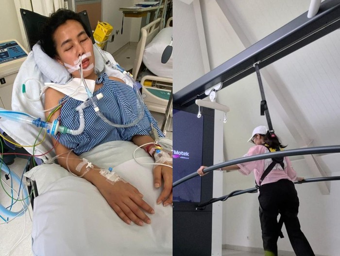 Kisah Wanita Jaksel Kena Tumor Otak di Usia 27, Ini Gejala Awalnya