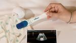 Chelsea Islan Pamer Baby Bump, Umumkan Hamil Anak Pertama