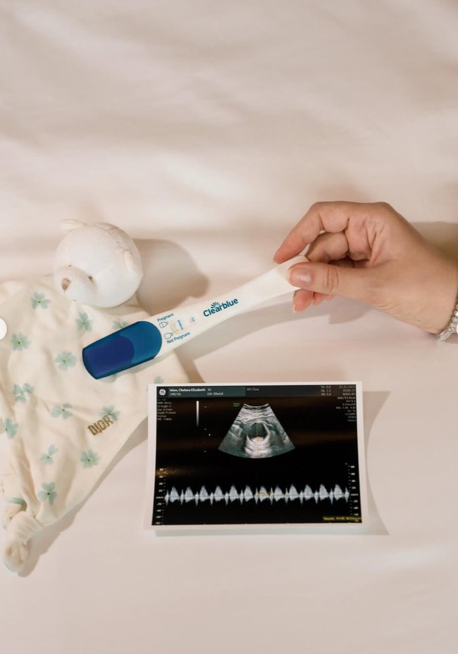Chelsea juga membagikan hasil test pack dan USG kehamilannya. Foto: Instagram/@chelseaislan