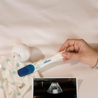 Chelsea juga membagikan hasil test pack dan USG kehamilannya. Foto: Instagram/@chelseaislan