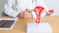PCOS Berganti Nama Menjadi PMOS, Apa Bedanya? Ini Penjelasan Obgyn