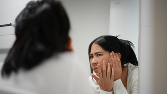 Diet Rendah Gula Bisa Atasi Jerawat? Ini Faktanya