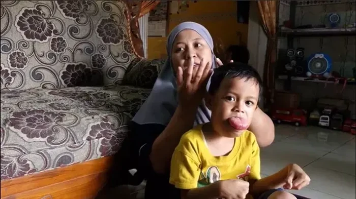Cerita Febio, Bocah 6 Tahun yang Hidup dengan Tumor Lidah