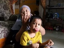 Cerita Febio, Bocah 6 Tahun yang Hidup dengan Tumor Lidah