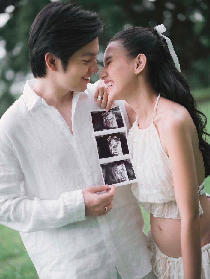 Cihuy Selamat! Shenina Cinnamon Hamil Anak Pertama