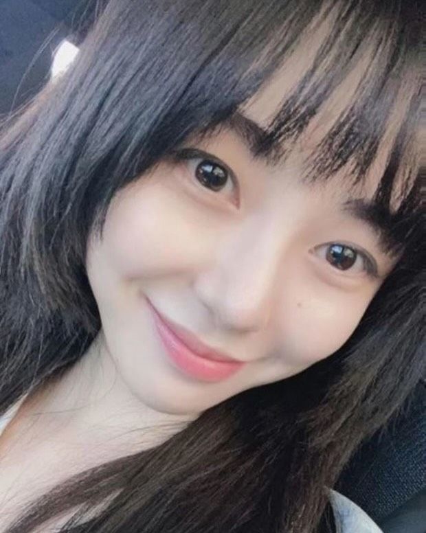 Kwon Mina Kwon Mina mengalami luka bakar setelah melakukan prosedur perawatan kulit.