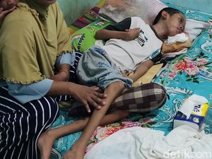 Cerita Pilu Nanda Remaja Kulon Progo 9 Tahun Lumpuh Usai Dipatuk Ular Weling