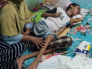 Cerita Pilu Nanda Remaja Kulon Progo 9 Tahun Lumpuh Usai Dipatuk Ular Weling