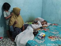 Perjuangan Ibu di Kulon Progo Rawat Nanda yang Lumpuh Usai Dipatuk Ular Weling