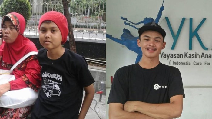 Bayu, survivor kanker anak.