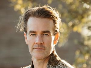 Video James Van Der Beek Meninggal Dunia, Didiagnosis Kanker Usus Sejak 2023