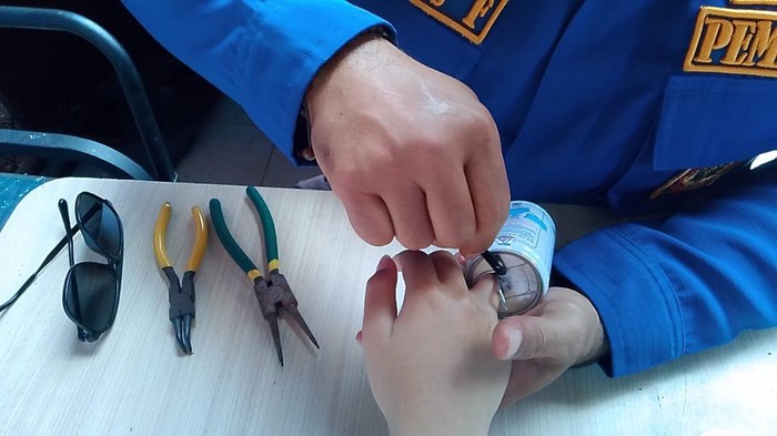 Proses evakuasi jari siswa yang terjebak di kaleng susu