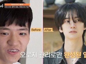 Tanpa Oplas! Cuma Ubah Rambut & Berat Badan, Wajah Pria Ini Mirip Idol K-Pop