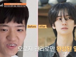 Tanpa Oplas! Cuma Ubah Rambut & Berat Badan, Wajah Pria Ini Mirip Idol K-Pop