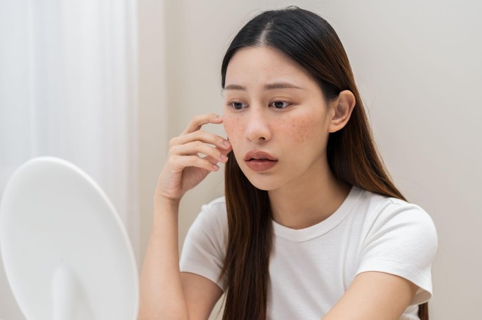 Ilustrasi masalah pada kulit wajah.