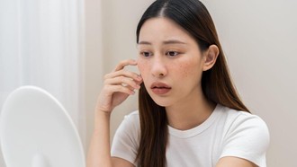 Wajah Mulai Berubah? Bisa Jadi Tanda-tanda Tubuh Kekurangan Kolagen
