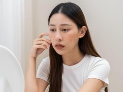 3 Cara Ampuh Atasi Pori-pori Tersumbat yang Disarankan Dokter Kulit