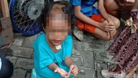 Pilu Nasib Balita Dianiaya-Dibotaki Paman dan Bibi di Surabaya