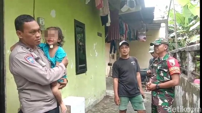 Balita korban penganiayaan oleh paman dan bibinya hingga kepalanya botak.