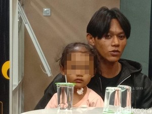 Kondisi Balita Korban Penyiksaan Paman-Bibi di Surabaya