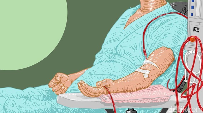 Ilustrasi pasien cuci darah
