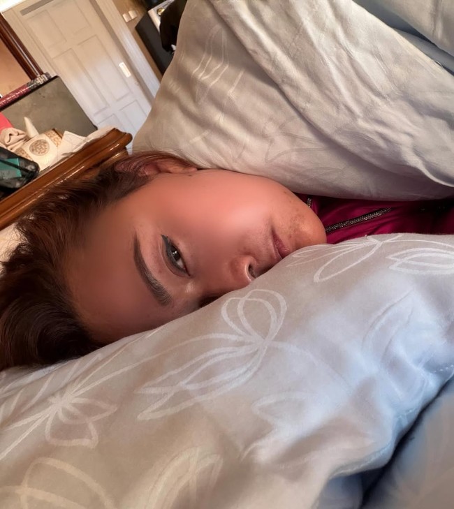 Pemilik karaoke Inul Vista itu mengaku mengungkap sudah sekitar tiga bulan tidak melakukan perawatan di klinik kecantikan. Ia pun mempersilakan pengikutnya di Instagram untuk memperbesar foto agar bisa melihat kondisi kulitnya secara jelas, sekaligus membuktikan dirinya tidak menggunakan filter. Foto: Dok. Instagram Inul Daratista