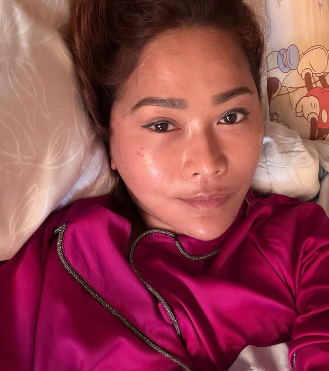 Inul dengan jujur memperlihatkan kondisi kulit wajahnya apa adanya. Ia mengaku mulai muncul bintik-bintik flek di wajah yang bersifat alami dan tidak bisa hilang begitu saja. Menurutnya, flek tersebut justru semakin bertambah seiring waktu. Foto: Dok. Instagram Inul Daratista