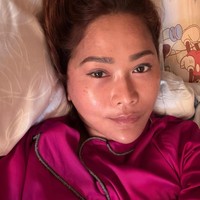 Inul dengan jujur memperlihatkan kondisi kulit wajahnya apa adanya. Ia mengaku mulai muncul bintik-bintik flek di wajah yang bersifat alami dan tidak bisa hilang begitu saja. Menurutnya, flek tersebut justru semakin bertambah seiring waktu. Foto: Dok. Instagram Inul Daratista