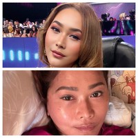 Potret Inul Daratista Pakai dan Tanpa Makeup, Kulit Aslinya Jadi Sorotan