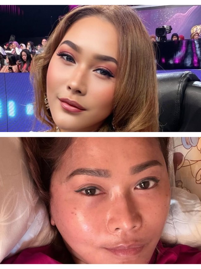 Potret Inul Daratista Pakai dan Tanpa Makeup, Kulit Aslinya Jadi Sorotan