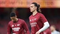 Arteta Heran Pemain Arsenal Gampang Cedera saat Pemanasan
