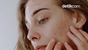 Video: Masuk Usia 25+, Kenapa Kulit Mulai Berubah?