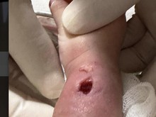 Viral Tangan Bayi Bengkak-Berlubang Usai Diinfus di RS Paramount Makassar