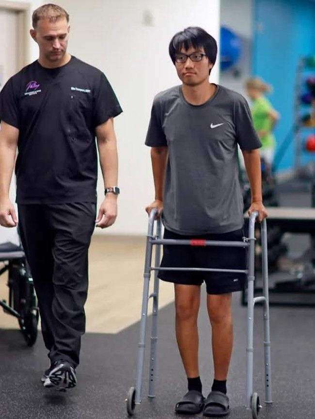 Potret Pria Jalani Operasi Peninggi Badan, Rogoh Kocek Rp 2,3 M Demi Tinggi Ideal