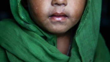 Selain warnanya yang terang, matanya juga sangat bulat. Foto: Mou Aysha via Bored Panda