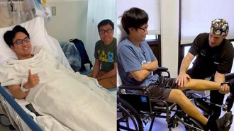 Pria Habiskan Rp 2,3 M untuk Operasi Tinggi Badan, Nggak PD Terlihat 'Pendek'