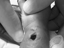 Kronologi Tangan Bayi Bengkak-Berlubang Usai Diinfus di RS Paramount Makassar