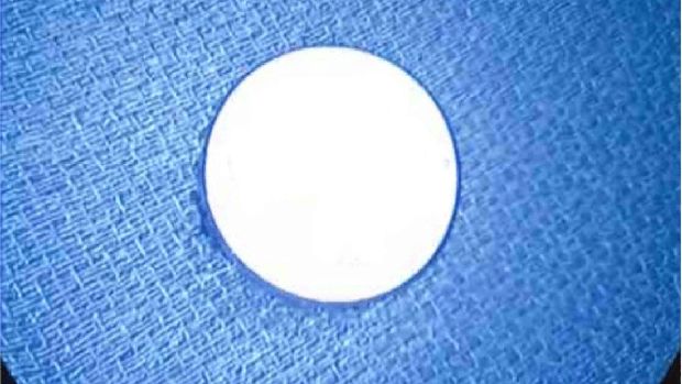 Tutup botol menyangkut di tenggorokan Tutup botol menyangkut di tenggorokan