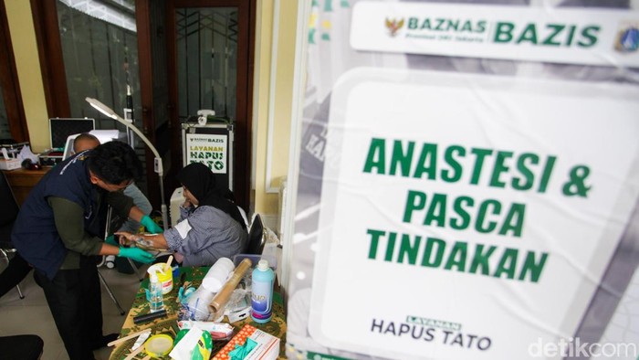 Peserta menjalani proses penghapusan tato dalam program yang digelar Badan Amil Zakat Nasional di Masjid Agung Sunda Kelapa, Senin (23/2/2026).