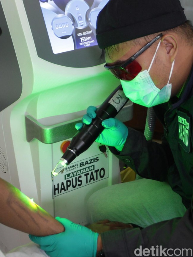 Antusias Warga Ikuti Program Hapus Tato Gratis di Masjid Sunda Kelapa