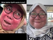 Wanita Jaksel Breakout Parah, Alami Gejala Ini Pasca Stop Skincare Steroid