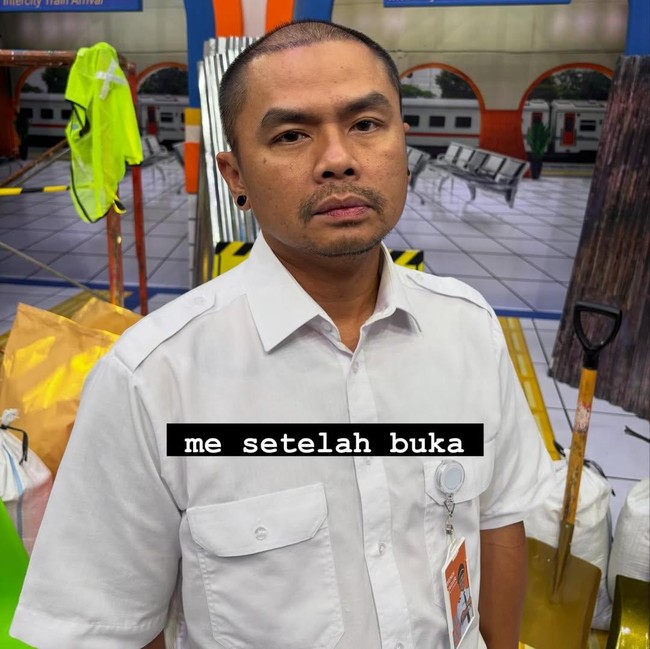 Alasan Wendi Cagur Transplantasi Rambut: Bukan Gaya Tapi Faktor Kesehatan!