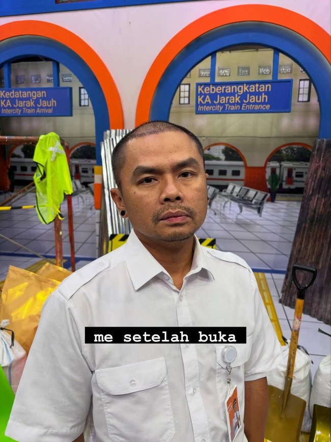 Alasan Wendi Cagur Transplantasi Rambut: Bukan Gaya Tapi Faktor Kesehatan!