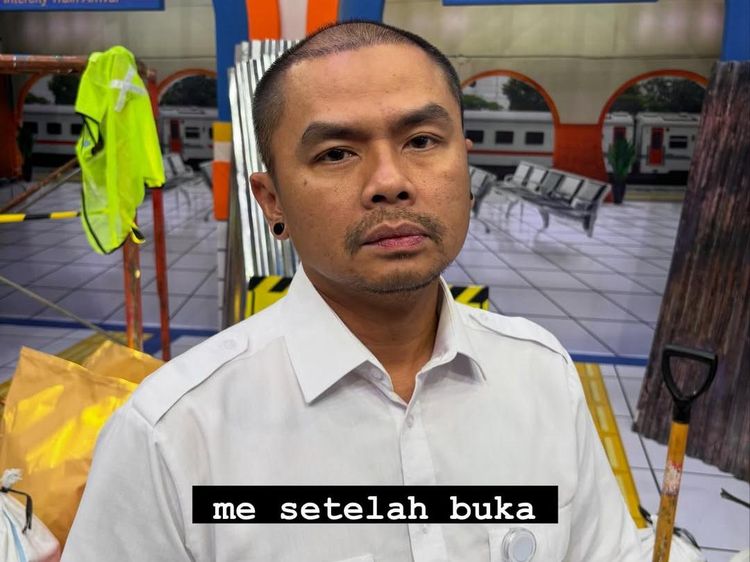 Alasan Wendi Cagur Transplantasi Rambut: Bukan Gaya Tapi Faktor Kesehatan!