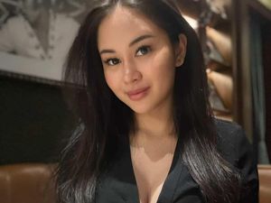 Penampilan Yasmine Karenina Usai Lakukan Oplas Payudara-Hidung