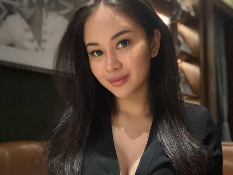 Penampilan Yasmine Karenina Usai Lakukan Oplas Payudara-Hidung