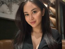 Penampilan Yasmine Karenina Usai Lakukan Oplas Payudara-Hidung